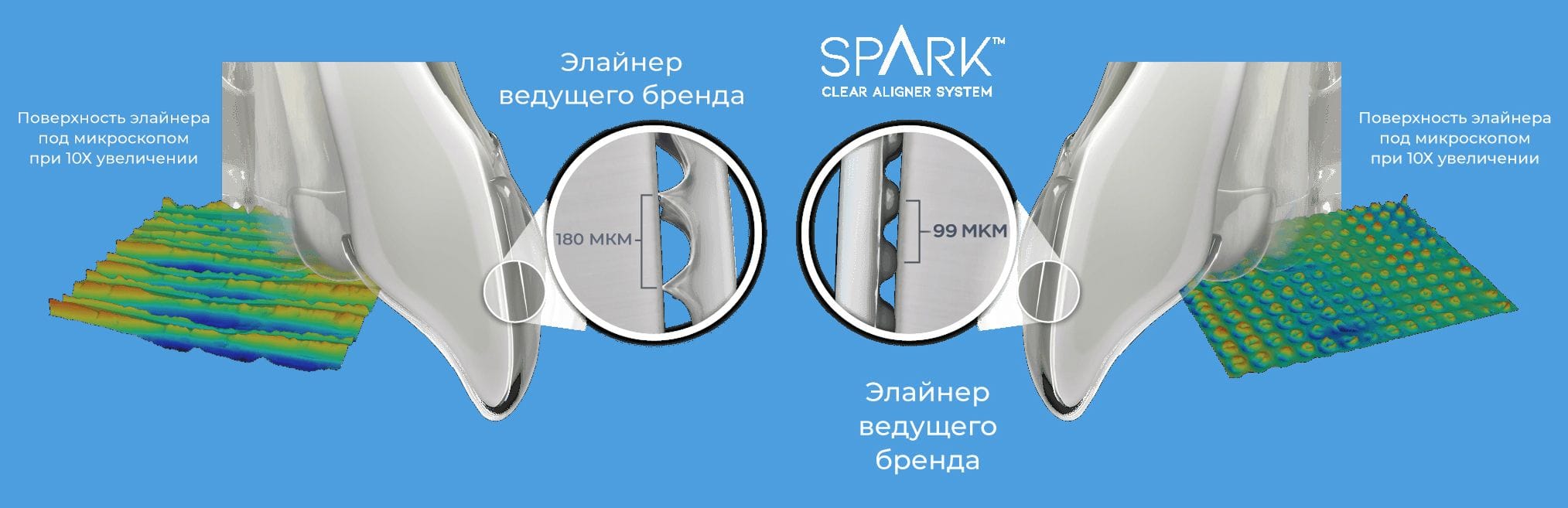 Сравнение контакта элайнера Spark и ведущего бренда